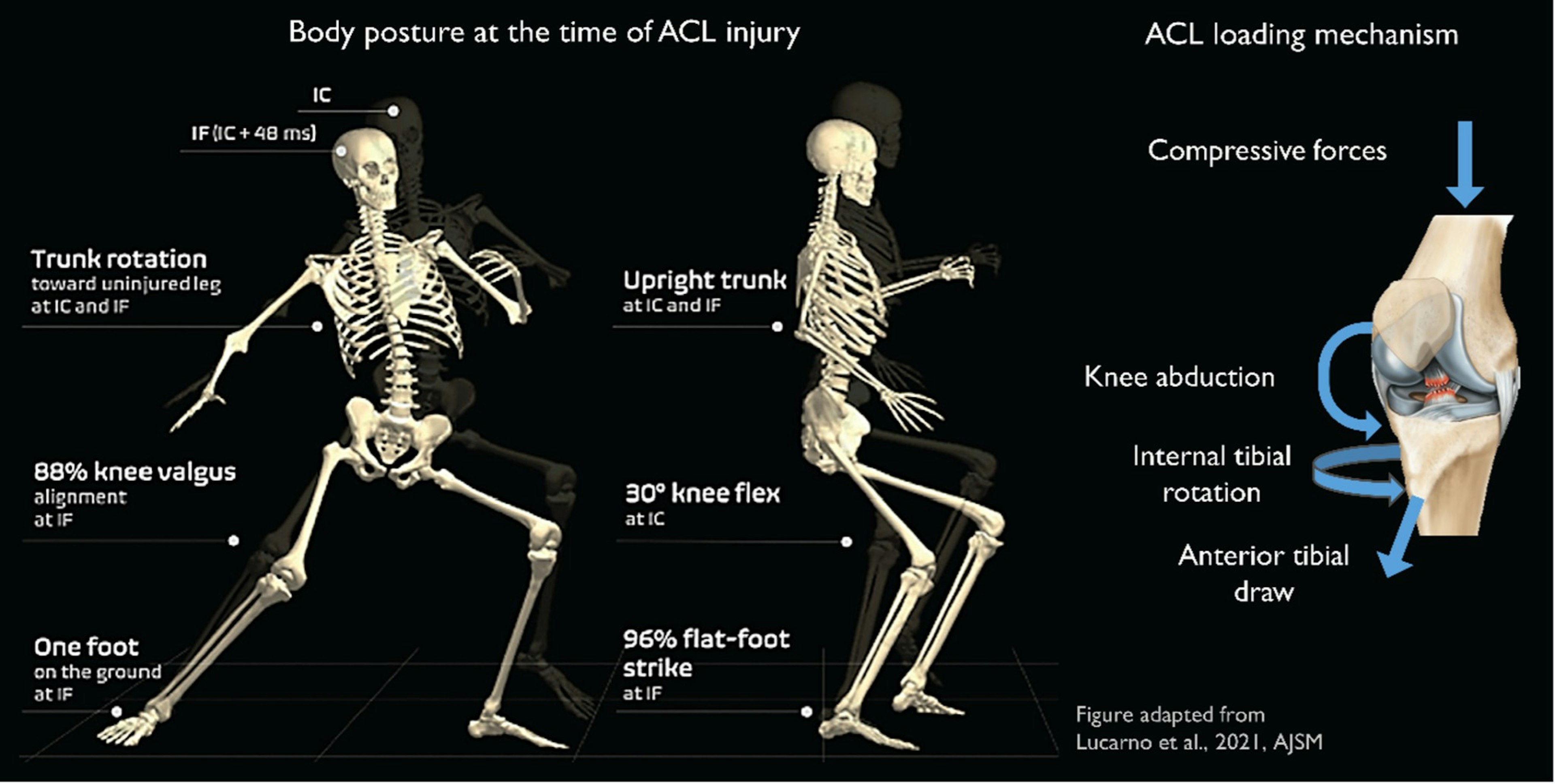 ACL損傷に関わる生体力学的要因の例。Lucameo et al 2021より引用