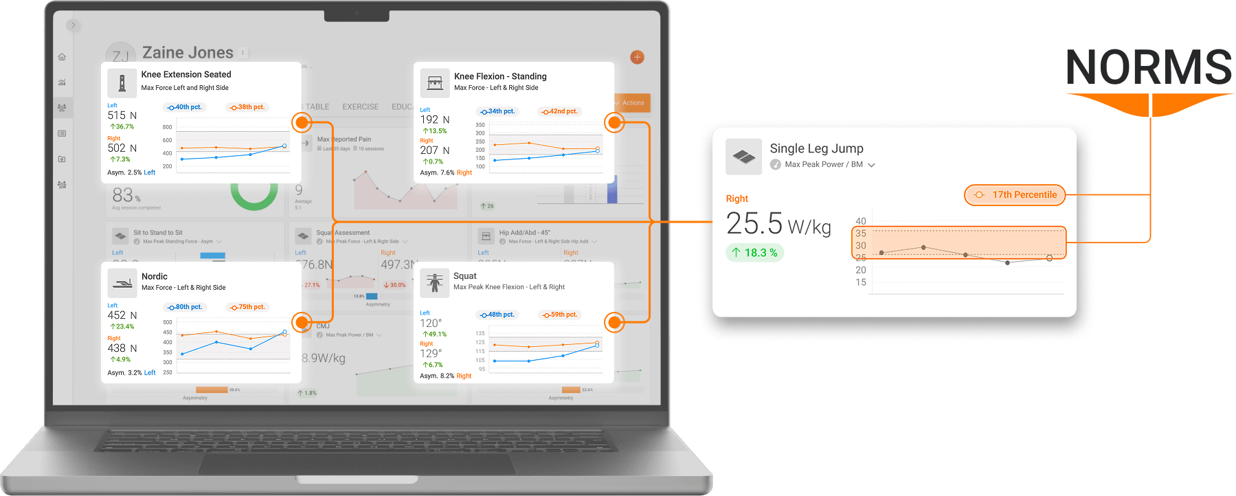 ForceDecks, DynaMo, NordBord, ForceFrame and HumanTrak Norms (normative data) integrated into VALD Hub.