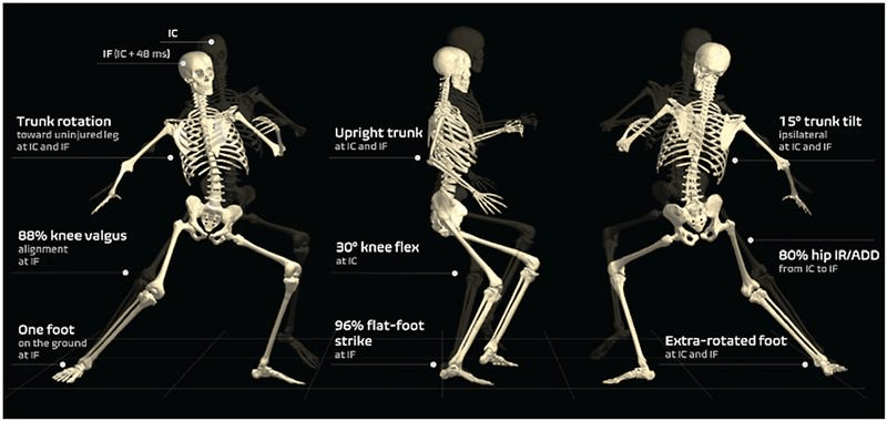 Body positions and movement patterns associated with ACL rupture risk (adapted from Lucarno et al., 2021).