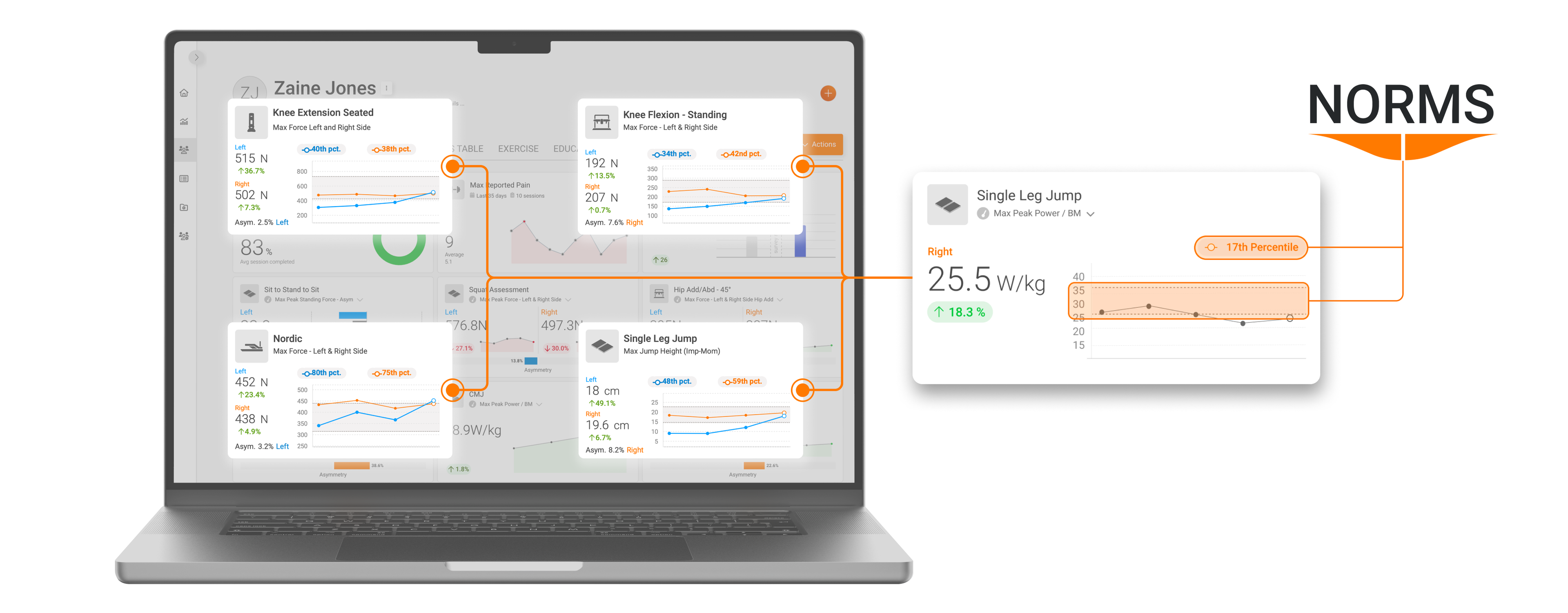 ForceDecks, DynaMo, NordBord and ForceFrame Norms (normative data) integrated into VALD Hub. 