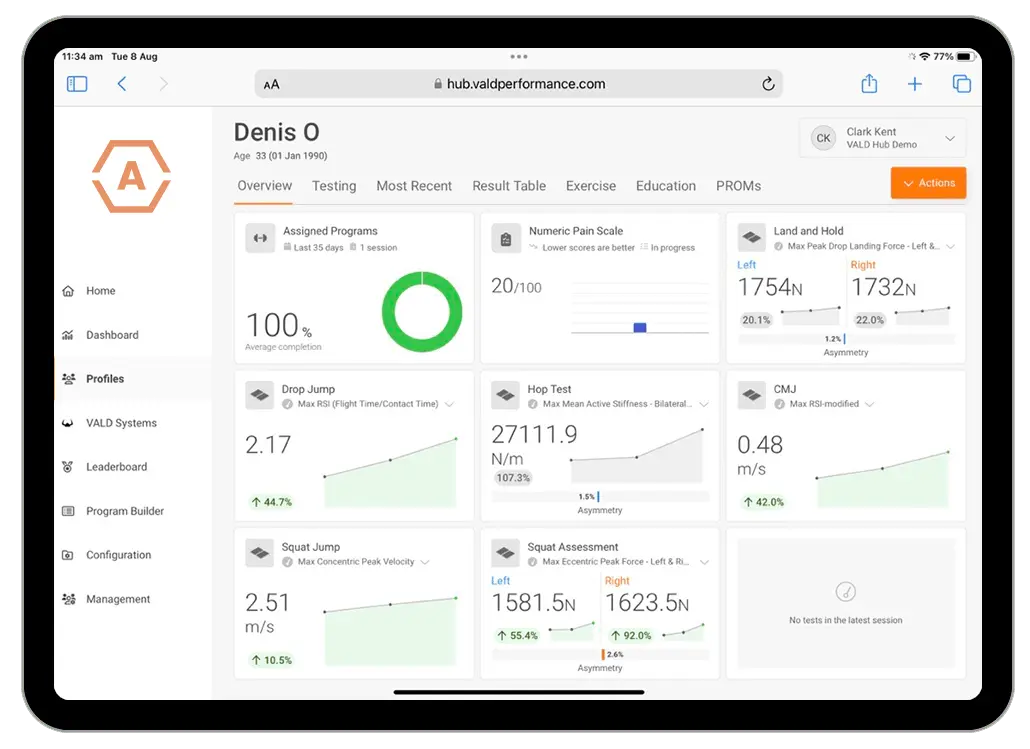 VALD Hub athlete profile displaying a number of metrics from the plyometric continuum (along with other VALD data), all in one dashboard.