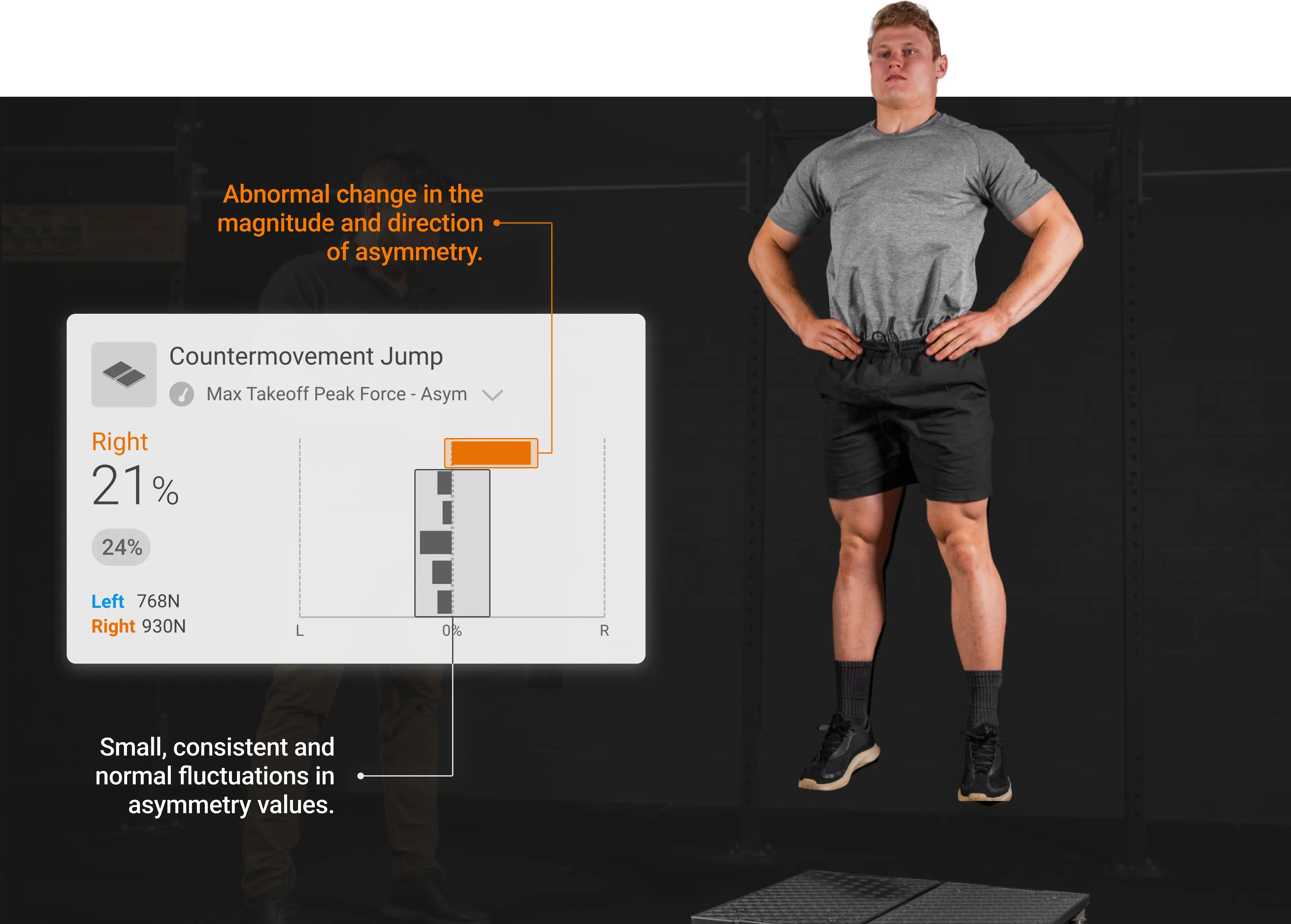 Visualization of longitudinal asymmetry monitoring with examples of acceptable and abnormal changes in asymmetry.