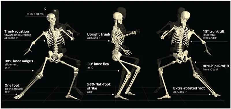 Body positions and movement patterns associated with ACL rupture risk (adapted from Lucarno et al., 2021).