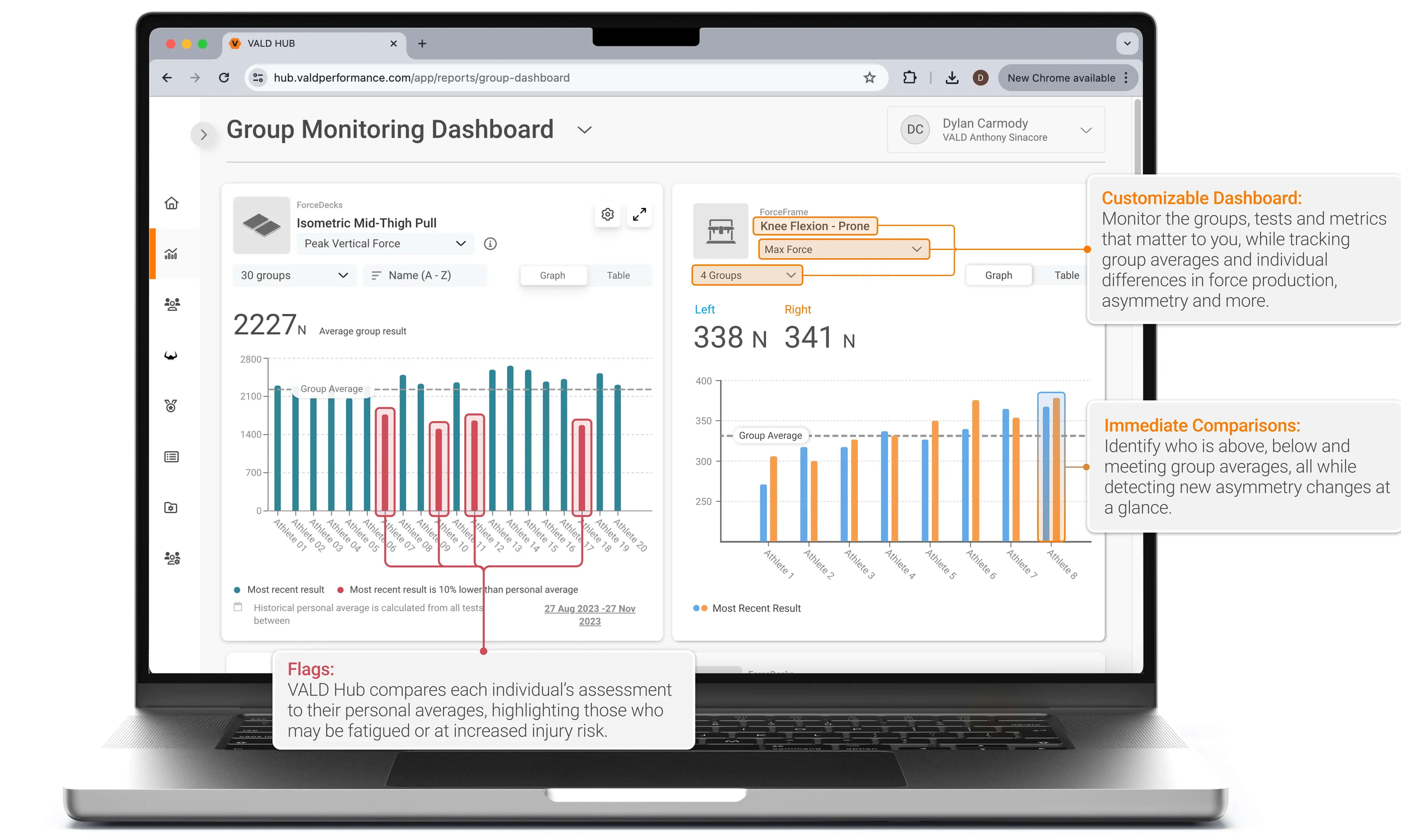 Visualizations of two different monitoring reports in VALD Hub, for identifying changes, asymmetries and outliers at a glance