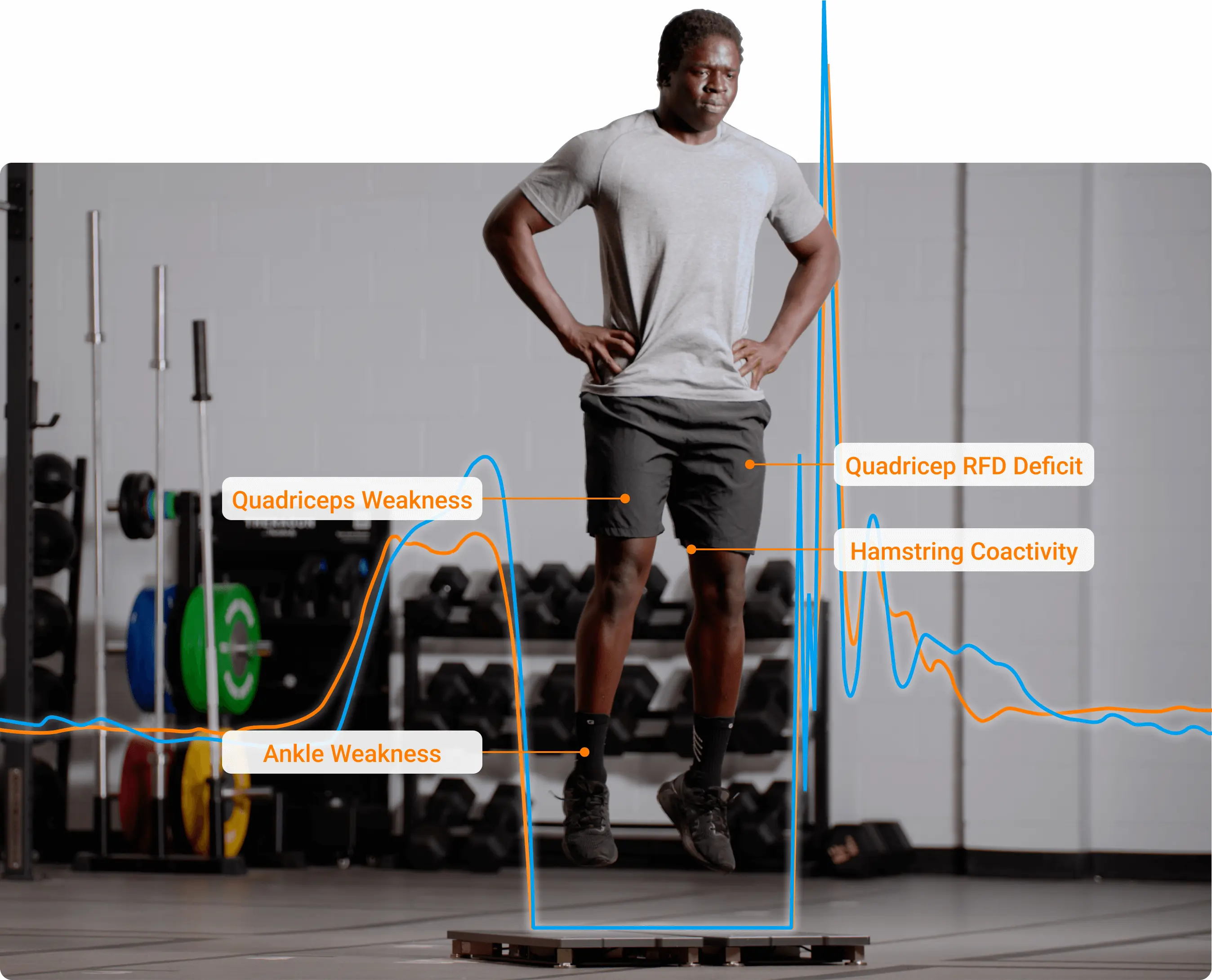 Right and left force traces depicting asymmetry during the takeoff phase, with potential explanations for common asymmetrical jump impairments.